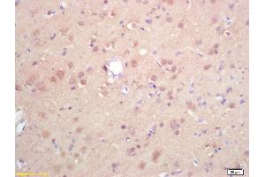 Formalin-fixed and paraffin embedded rat brain labeled with Rabbit Anti DGAT1/Diglyceride acyltransferase Polyclonal Antibody, Unconjugated (ABIN679568) at 1:200 followed by conjugation to the secondary antibody and DAB staining (DGAT1 抗体  (AA 251-350))