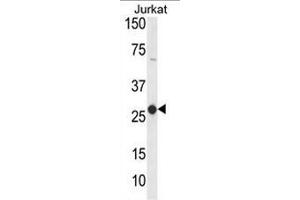 Western blot analysis of CD160 Antibody (Center) in Jurkat cell line lysates (35µg/lane). (CD160 抗体  (Middle Region))