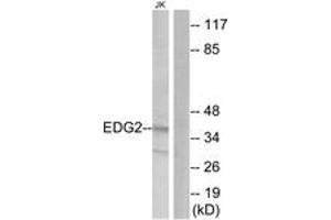 Western blot analysis of extracts from Jurkat cells, using EDG2 Antibody. (BUD31 抗体  (AA 5-54))