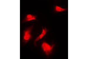 Immunofluorescent analysis of S6K1 (pS418) staining in HeLa cells. (RPS6KB1 抗体  (C-Term, pSer418))