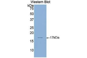Western blot analysis of the recombinant protein. (Laminin alpha 1 抗体  (AA 2613-2746))