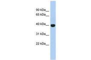 Image no. 1 for anti-KIAA1191 (KIAA1191) (AA 179-228) antibody (ABIN6744040) (KIAA1191 抗体  (AA 179-228))
