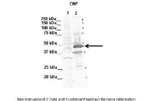 Lanes:   1. (Cnpase 抗体  (N-Term))