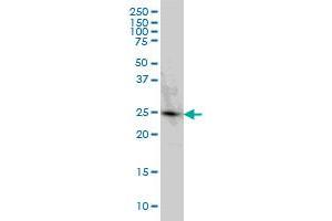 PGRMC2 monoclonal antibody (M04), clone 3C11 Western Blot analysis of PGRMC2 expression in HeLa (PGRMC2 抗体  (AA 124-223))