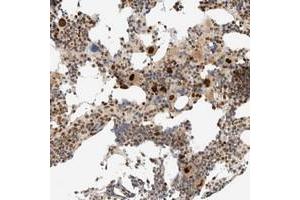 Immunohistochemical staining of human bone marrow with ZBTB34 polyclonal antibody  shows strong nuclear positivity in megakaryocytes.