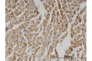 Image no. 1 for anti-2,4-Dienoyl CoA Reductase 1, Mitochondrial (DECR1) (AA 236-336) antibody (ABIN599370) (DECR1 抗体  (AA 236-336))