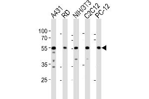 Western blot analysis of lysates from A431, RD, mouse NIH/3T3, mouse C2C12, rat PC-12 cell line (from left to right), using SRC Antibody (N-term) (ABIN1881832 and ABIN2838676).