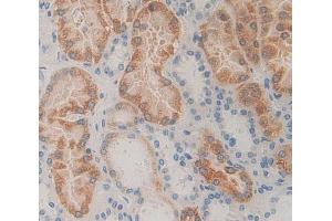 Used in DAB staining on fromalin fixed paraffin- embedded Kidney tissue (PNPO 抗体  (AA 1-261))