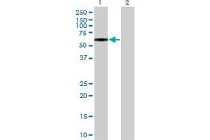 Western Blotting (WB) image for anti-Purinergic Receptor P2X, Ligand-Gated Ion Channel, 4 (P2RX4) (AA 1-388) antibody (ABIN518565)