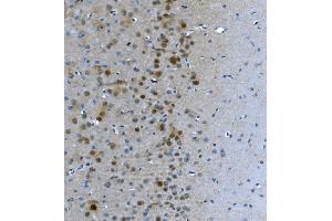 IHC analysis of LSM7 using anti-LSM7 antibody (ABIN7598937). (LSM7 抗体  (AA 1-103))