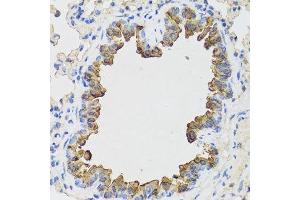 Immunohistochemistry of paraffin-embedded mouse lung using B9D1 antibody. (B9D1 抗体  (AA 1-130))