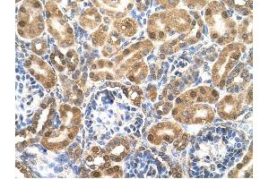 Enolase 3 antibody was used for immunohistochemistry at a concentration of 4-8 ug/ml to stain Epithelial cells of renal tubule (arrows) in Human Kidney. (ENO3 抗体)