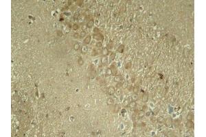 Immunohistochemical analysis of paraffin-embedded rat hippocampal region tissue from a model with Alzheimer (MAPT 抗体  (pSer262))