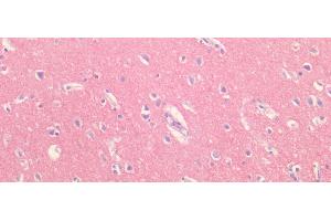 Immunohistochemistry (IHC) image for anti-beta-Site APP-Cleaving Enzyme 2 (BACE2) (AA 242-502) antibody (ABIN7438730)