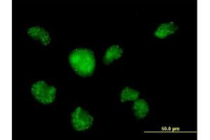 Immunofluorescence of purified MaxPab antibody to CALML3 on HeLa cell. (CALML3 抗体  (AA 1-149))