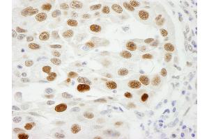 Immunohistochemistry (IHC) image for anti-Importin Subunit alpha-1 (KPNA2) (C-Term) antibody (ABIN7448767) (Importin Subunit alpha-1 (KPNA2) (C-Term) 抗体)