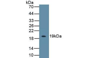 Detection of Recombinant IL18BP, Mouse using Polyclonal Antibody to Interleukin 18 Binding Protein (IL18BP) (IL18BP 抗体  (AA 29-193))