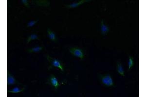 Immunofluorescent analysis of HepG2 cells using ABIN7170565 at dilution of 1:100 and Alexa Fluor 488-congugated AffiniPure Goat Anti-Rabbit IgG(H+L) (S1PR1 抗体  (AA 311-382))