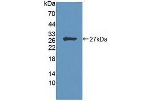 Detection of Recombinant HIPK2, Human using Polyclonal Antibody to Homeodomain Interacting Protein Kinase 2 (HIPK2) (HIPK2 抗体  (AA 977-1198))