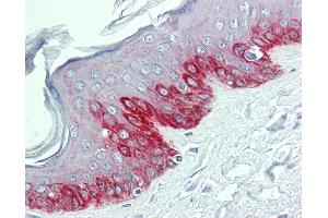 Anti-HDX antibody IHC of human skin. (HDX 抗体  (N-Term))