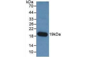 Detection of Recombinant ANGPT1, Human using Monoclonal Antibody to Angiopoietin 1 (ANGPT1) (Angiopoietin 1 抗体  (AA 284-452))