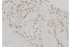 ABIN6276555 at 1/100 staining Human lung tissue by IHC-P. (RRM1 抗体  (Internal Region))