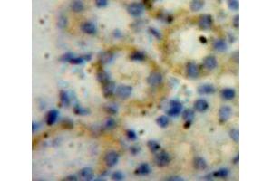 Used in DAB staining on fromalin fixed paraffin-embedded Kidney tissue (ADAMTS1 抗体  (AA 560-911))