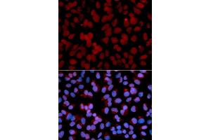 Immunofluorescence analysis of U2OS cells using TNF antibody (ABIN6128830, ABIN6149292, ABIN6149293 and ABIN6217713). (TNFAIP3 抗体  (AA 1-190))