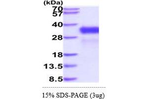 Retinoic Acid Early Transcript 1E (RAET1E) (AA 31-225) protein (His tag)