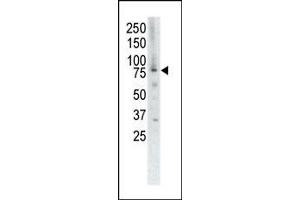 Western blot analysis of anti-MUSK Pab (ABIN392020 and ABIN2841796) in placenta cell lysate.