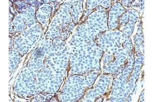 Immunohistochemistry (IHC) image for anti-Nerve Growth Factor Receptor (NGFR) (AA 1-160), (Extracellular Domain) antibody (ABIN3025050)