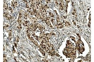 IHC analysis of Transketolase/TKT using anti-Transketolase/TKT antibody (ABIN7598959).