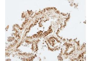 IHC-P Image Immunohistochemical analysis of paraffin-embedded human normal lung, using ZKSCAN3, antibody at 1:100 dilution. (ZKSCAN3 抗体)