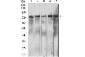 Western Blotting (WB) image for anti-Interleukin 10 Receptor, beta (IL10RB) (AA 20-220) antibody (ABIN7193262)