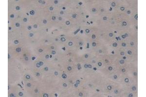 Immunohistochemistry (IHC) image for anti-R-Spondin 3 (RSPO3) (AA 22-272) antibody (ABIN7430150)