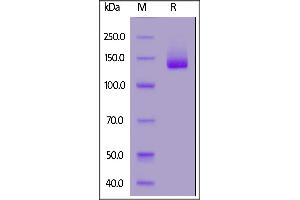 SDS-PAGE (SDS) image for Neural Cell Adhesion Molecule 1 (NCAM1) (AA 20-718) (Active) protein (Fc Tag) (ABIN7013592)