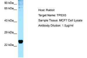 Western Blotting (WB) image for anti-Tumor Protein P53 Inducible Protein 3 (TP53I3) (C-Term) antibody (ABIN2789865) (TP53I3 抗体  (C-Term))