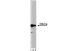 Western blot analysis of Karyopherin alpha on a HeLa cell lysate (Human cervical epitheloid carcinoma, ATCC CCL-2. (KPNA2 抗体  (AA 254-497))