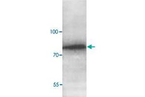 Western blot analysis of human fetal liver lysate with ABCG8 polyclonal antibody  at 1 : 1000 dilution. (ABCG8 抗体  (C-Term))