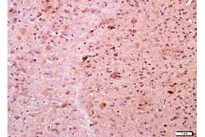 Paraformaldehyde-fixed, paraffin embedded mouse brain tissue, Antigen retrieval by boiling in sodium citrate buffer(pH6) for 15min, Block endogenous peroxidase by 3% hydrogen peroxide for 30 minutes, Blocking buffer (normal goat serum) at 37°C for 20min, Antibody incubation with Rabbit Anti-RANK Polyclonal Antibody, Unconjugated  at 1:400 overnight at 4°C, followed by a conjugated secondary and DAB staining (TNFRSF11A 抗体  (AA 101-200))