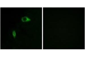 Immunofluorescence (IF) image for anti-Collagen, Type XIV, alpha 1 (COL14A1) (AA 71-120) antibody (ABIN1534355)