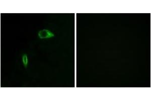 Immunofluorescence analysis of HeLa cells, using Collagen XIV alpha1 Antibody. (COL14A1 抗体  (AA 71-120))