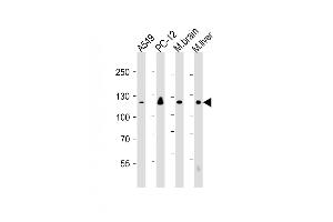 All lanes : Anti-EIF2AK3 Antibody at 1:250-1:1000 dilution Lane 1: A549 whole cell lysate Lane 2: PC-12 whole cell lysate Lane 3: mouse brain lysate Lane 4: mouse liver lysate Lysates/proteins at 20 μg per lane. (PERK 抗体  (AA 530-850))
