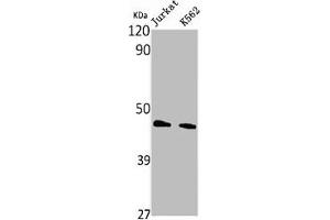 Western Blot analysis of Jurkat K562 cells using PHKG1 Polyclonal Antibody (PHKG1 抗体  (Internal Region))