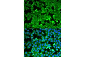 Immunofluorescence analysis of A549 cells using ASNS antibody. (Asparagine Synthetase 抗体  (AA 262-561))