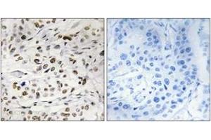 Immunohistochemistry (IHC) image for anti-High Mobility Group Nucleosome Binding Domain 1 (HMGN1) (AA 10-59), (pSer21) antibody (ABIN1531654)