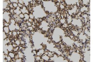ABIN6267136 at 1/100 staining Mouse lung tissue by IHC-P. (MCM3 抗体  (pSer112))