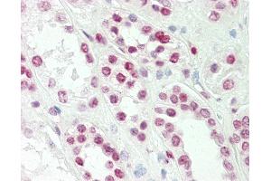 Anti-TLX1 / HOX11 antibody IHC staining of human kidney. (TLX1 抗体  (AA 163-191))