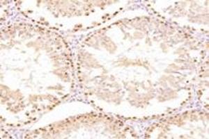 Immunohistochemistry analysis of paraffin-embedded mouse testis using,ZSCAN20 (ABIN7076252) at dilution of 1: 3000 (ZSCAN20 抗体)