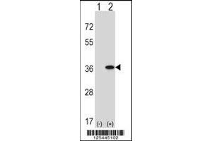 Western blot analysis of GNAQ using rabbit polyclonal GNAQ Antibody using 293 cell lysates (2 ug/lane) either nontransfected (Lane 1) or transiently transfected (Lane 2) with the GNAQ gene. (GNAQ 抗体  (N-Term))